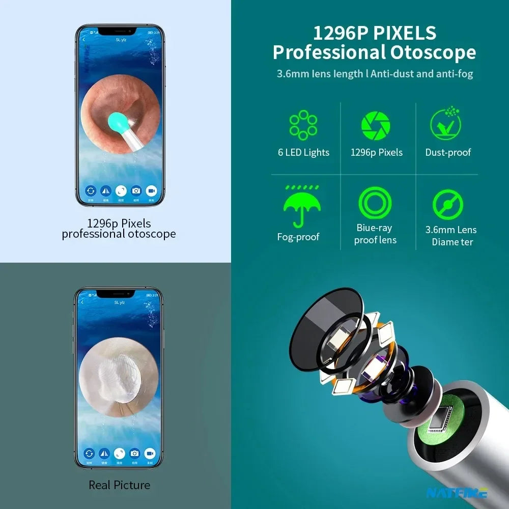 Smart Ear Cleaner with Camera