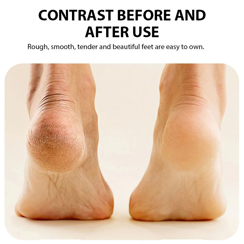 Electric Foot Grinder